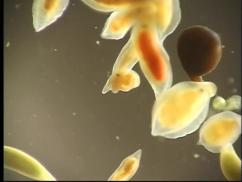 FLATWORMS